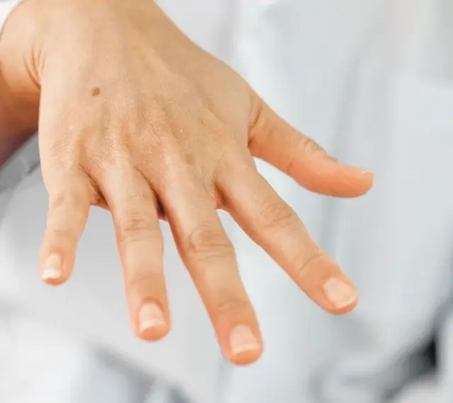 Una mano con algunas manchas, incluyendo un lunar visible en el dorso.